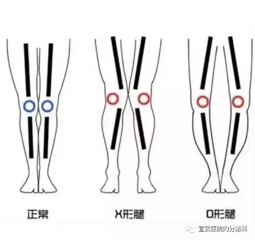 靠墙静蹲的正确姿势与时间_电脑点关机就会重启_练习英语口语注意点