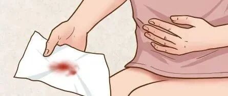 白带又多又粘，同房后出血，可能是这个原因