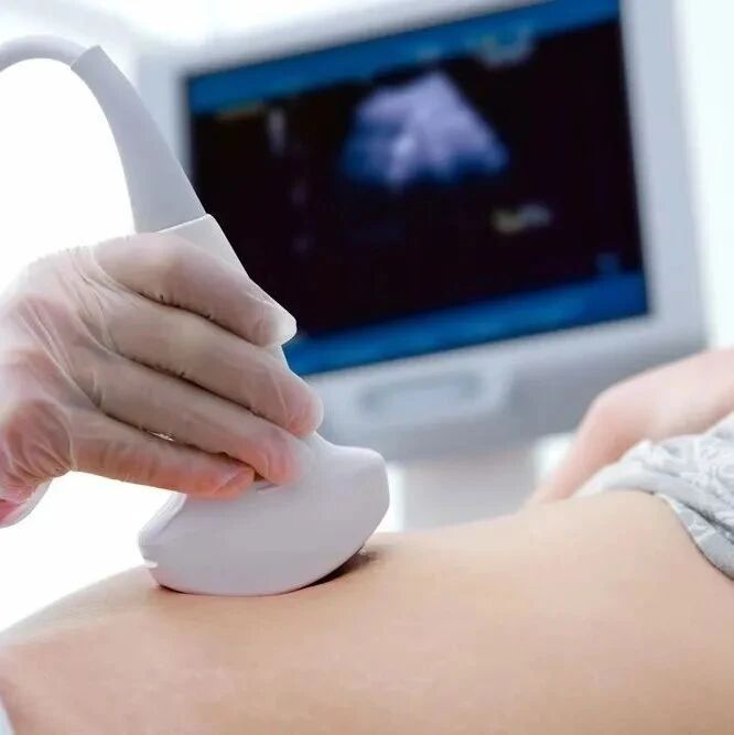 想要二宝，取环后多久可以备孕？