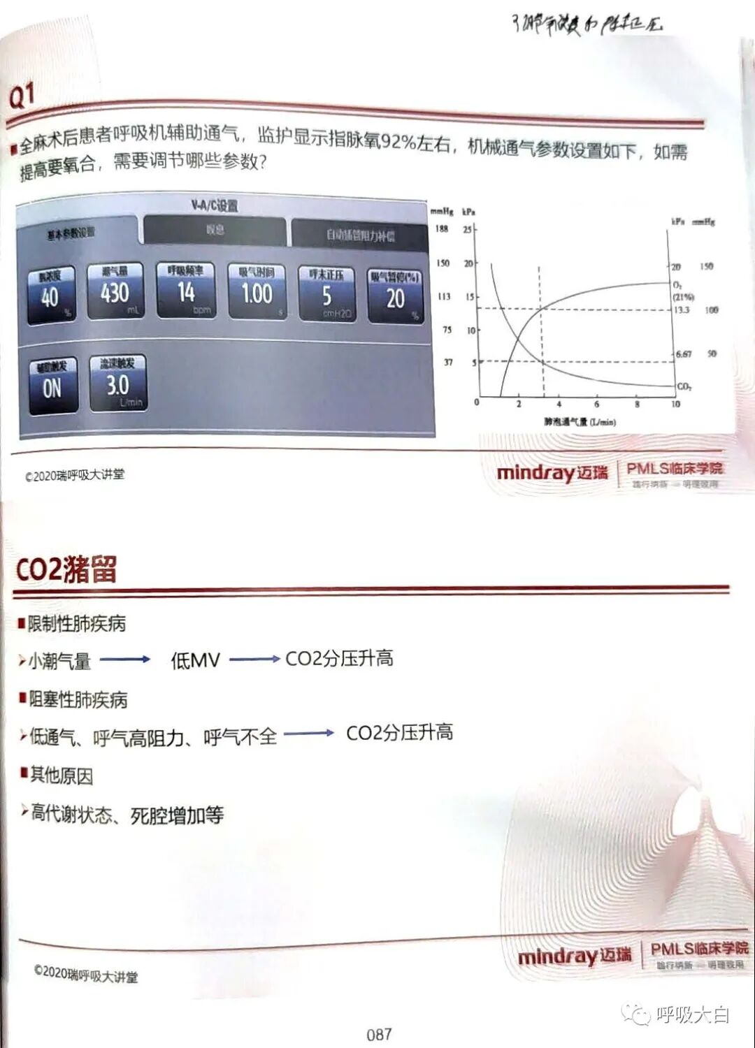 呼吸机的怎么调节6、如何设置和调节呼吸机_https://www.jmylbn.com_新闻资讯_第8张
