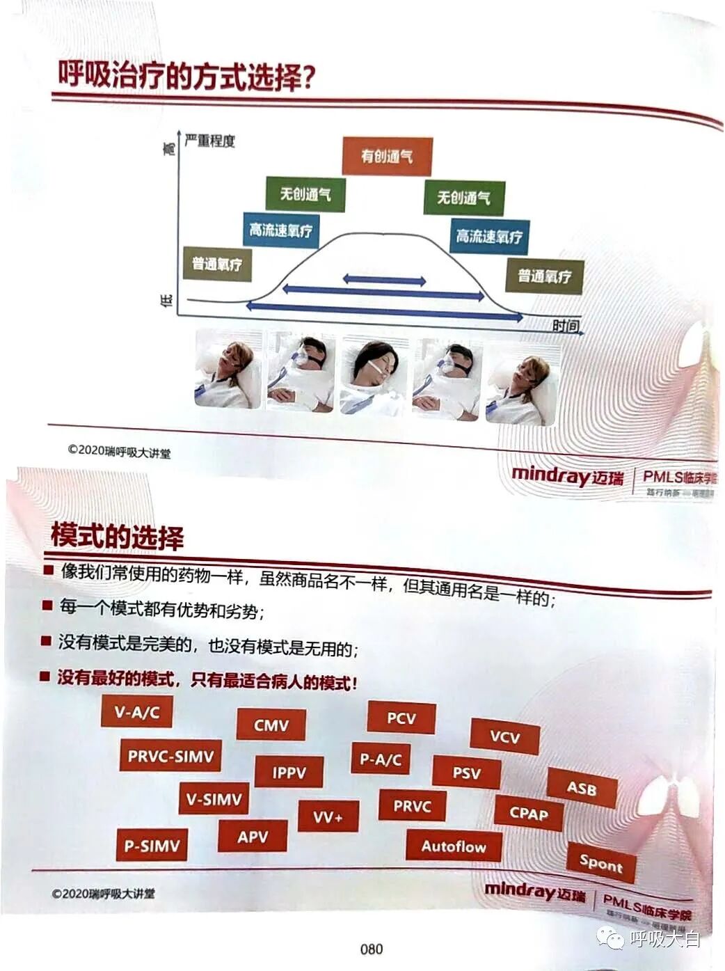 呼吸机的怎么调节6、如何设置和调节呼吸机_https://www.jmylbn.com_新闻资讯_第2张