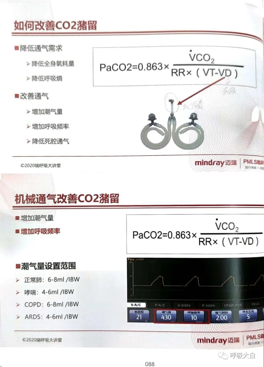 呼吸机的怎么调节6、如何设置和调节呼吸机_https://www.jmylbn.com_新闻资讯_第9张