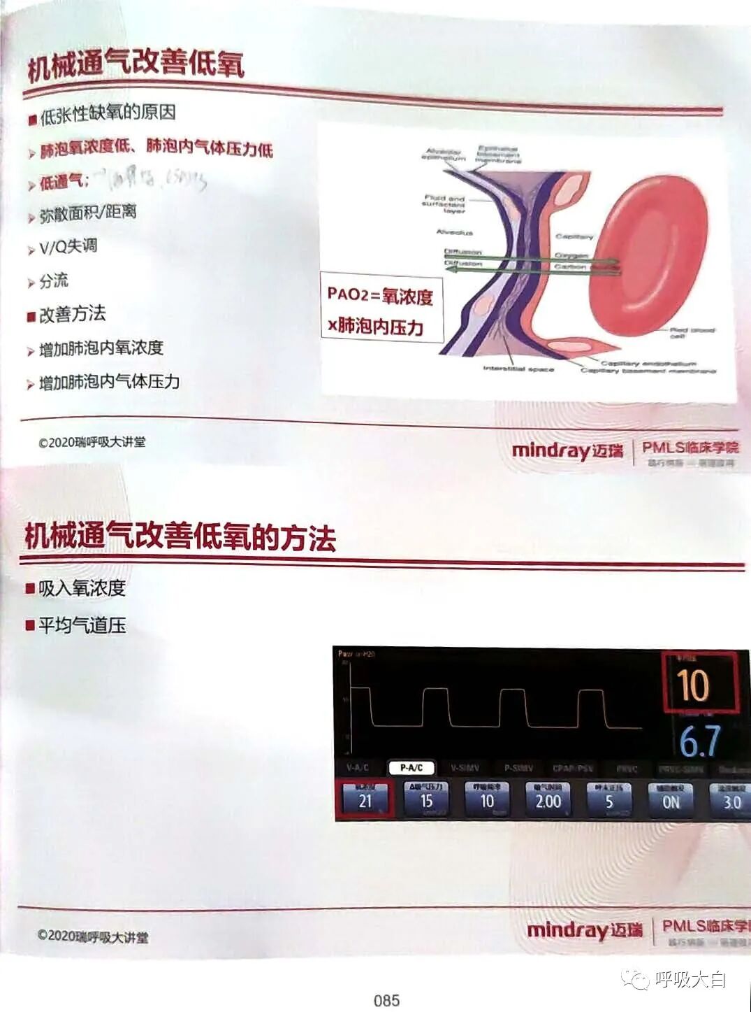 呼吸机的怎么调节6、如何设置和调节呼吸机_https://www.jmylbn.com_新闻资讯_第6张