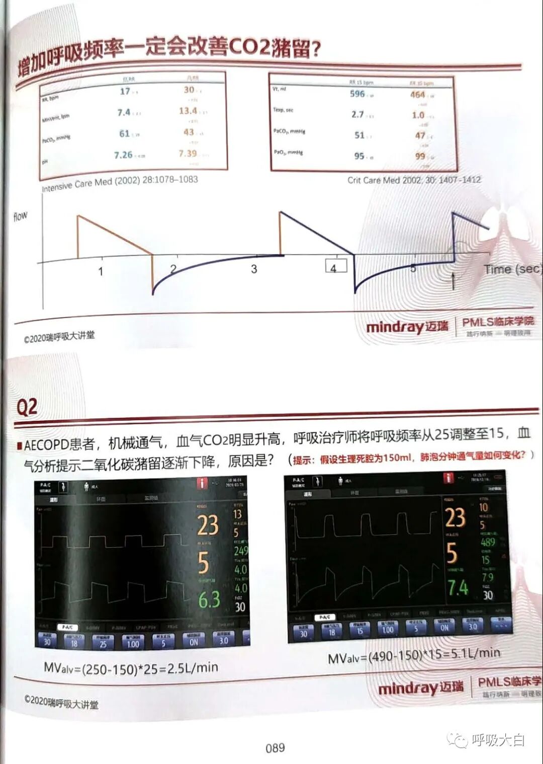 呼吸机的怎么调节6、如何设置和调节呼吸机_https://www.jmylbn.com_新闻资讯_第10张
