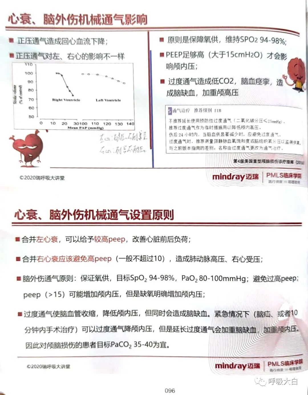 呼吸机的怎么调节6、如何设置和调节呼吸机_https://www.jmylbn.com_新闻资讯_第17张