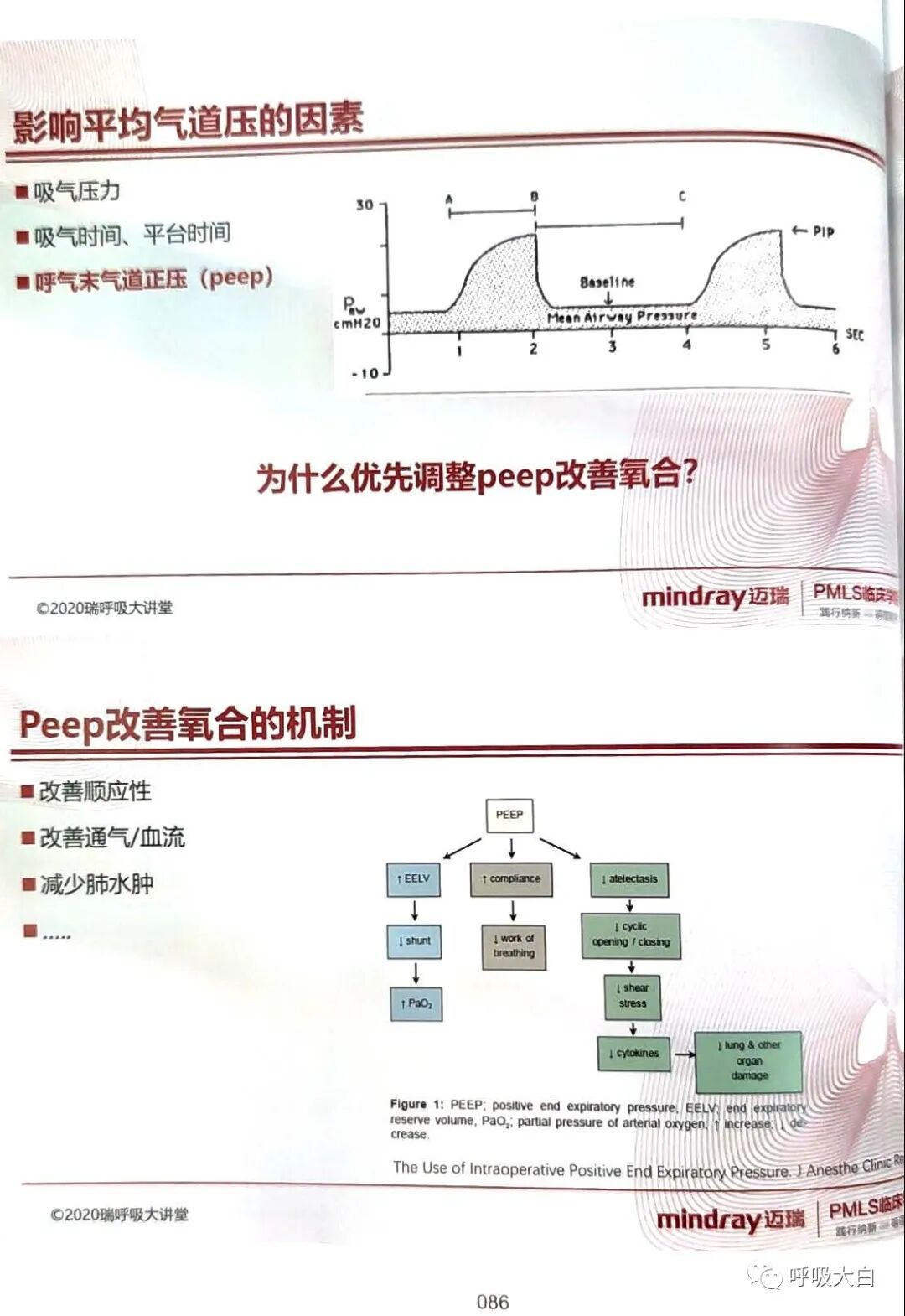 呼吸机的怎么调节6、如何设置和调节呼吸机_https://www.jmylbn.com_新闻资讯_第7张