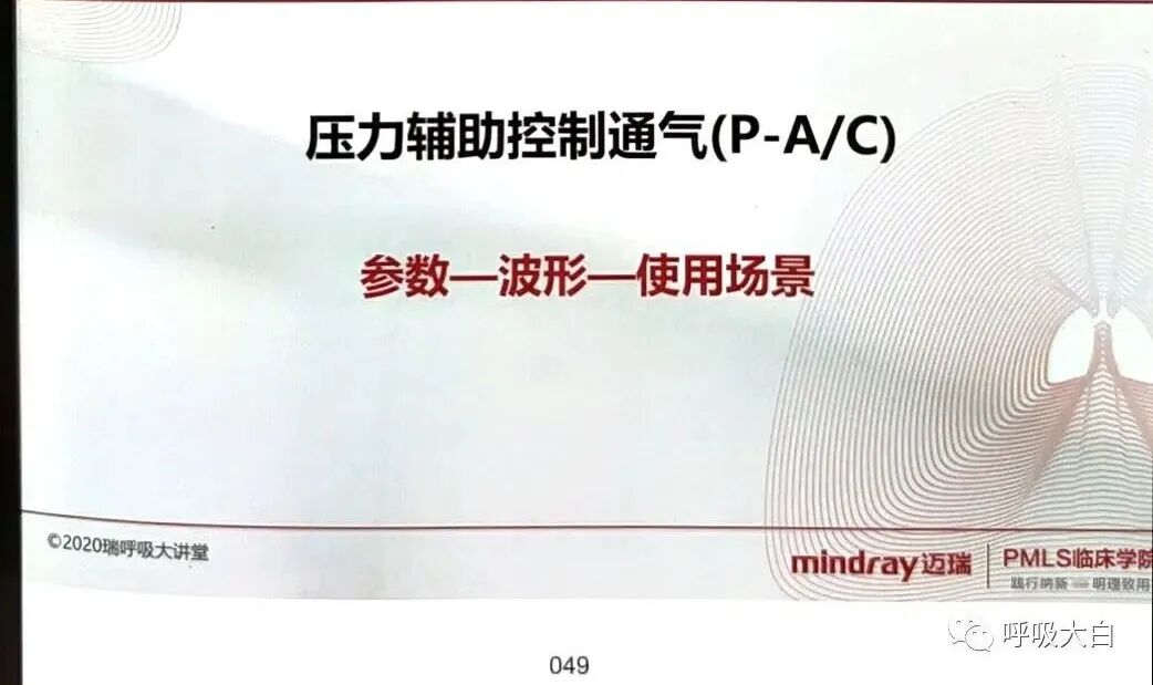 呼吸机pip是什么意思3压力控制辅助通气 P-A／C模式_https://www.jmylbn.com_新闻资讯_第4张