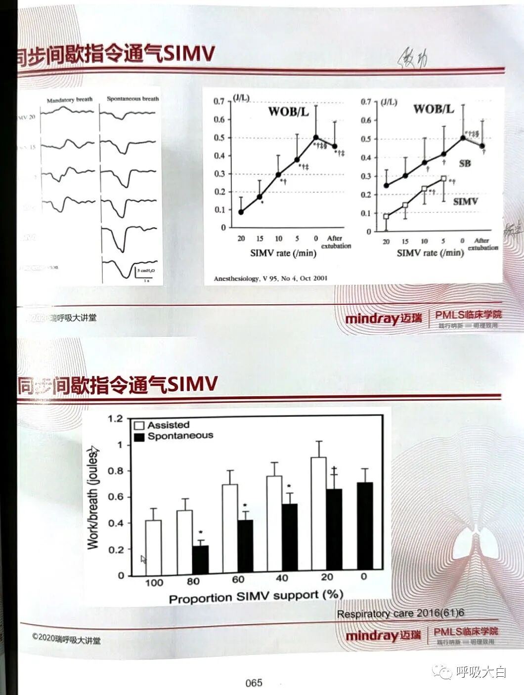 呼吸机pip是什么意思3如何理解通气模式（二）_https://www.jmylbn.com_新闻资讯_第7张