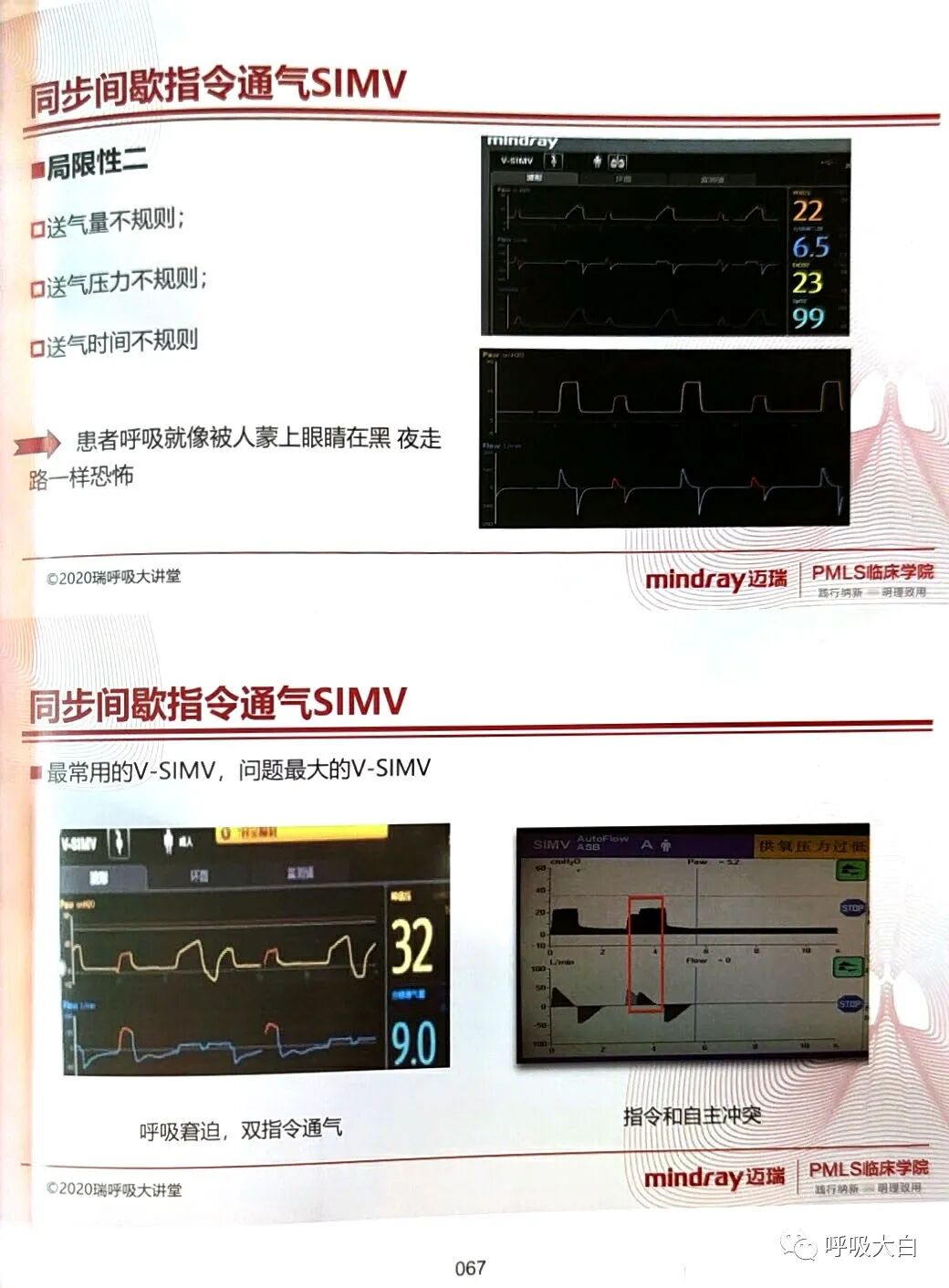 呼吸机pip是什么意思3如何理解通气模式（二）_https://www.jmylbn.com_新闻资讯_第9张