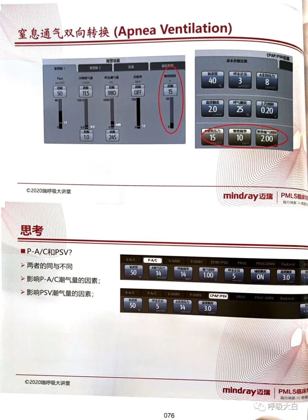 呼吸机pip是什么意思3如何理解通气模式（二）_https://www.jmylbn.com_新闻资讯_第18张