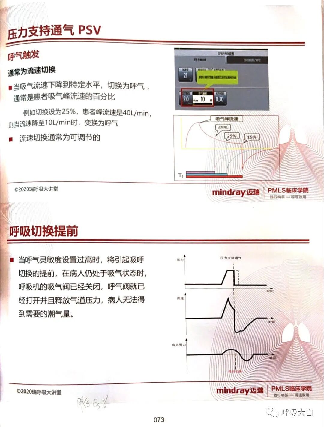 呼吸机pip是什么意思3如何理解通气模式（二）_https://www.jmylbn.com_新闻资讯_第15张