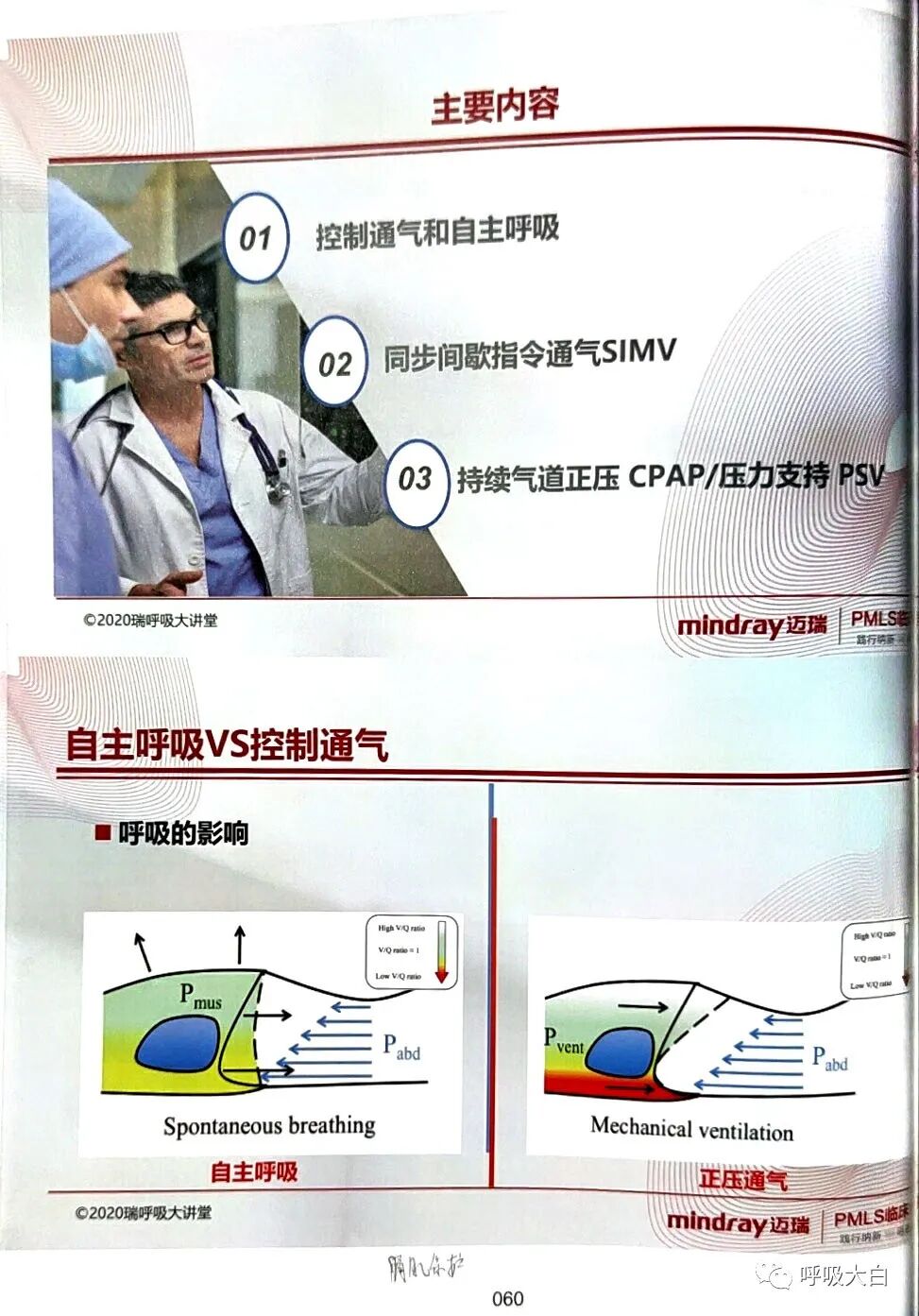 呼吸机pip是什么意思3如何理解通气模式（二）_https://www.jmylbn.com_新闻资讯_第2张