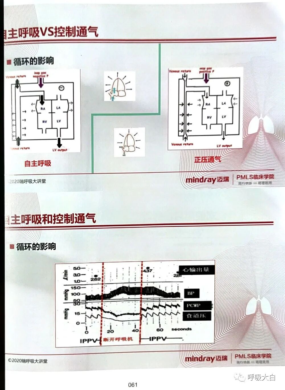 呼吸机pip是什么意思3如何理解通气模式（二）_https://www.jmylbn.com_新闻资讯_第3张