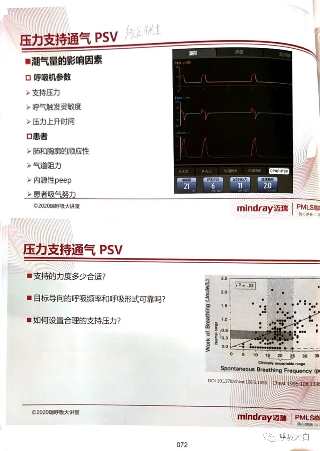 呼吸机pip是什么意思3如何理解通气模式（二）_https://www.jmylbn.com_新闻资讯_第14张