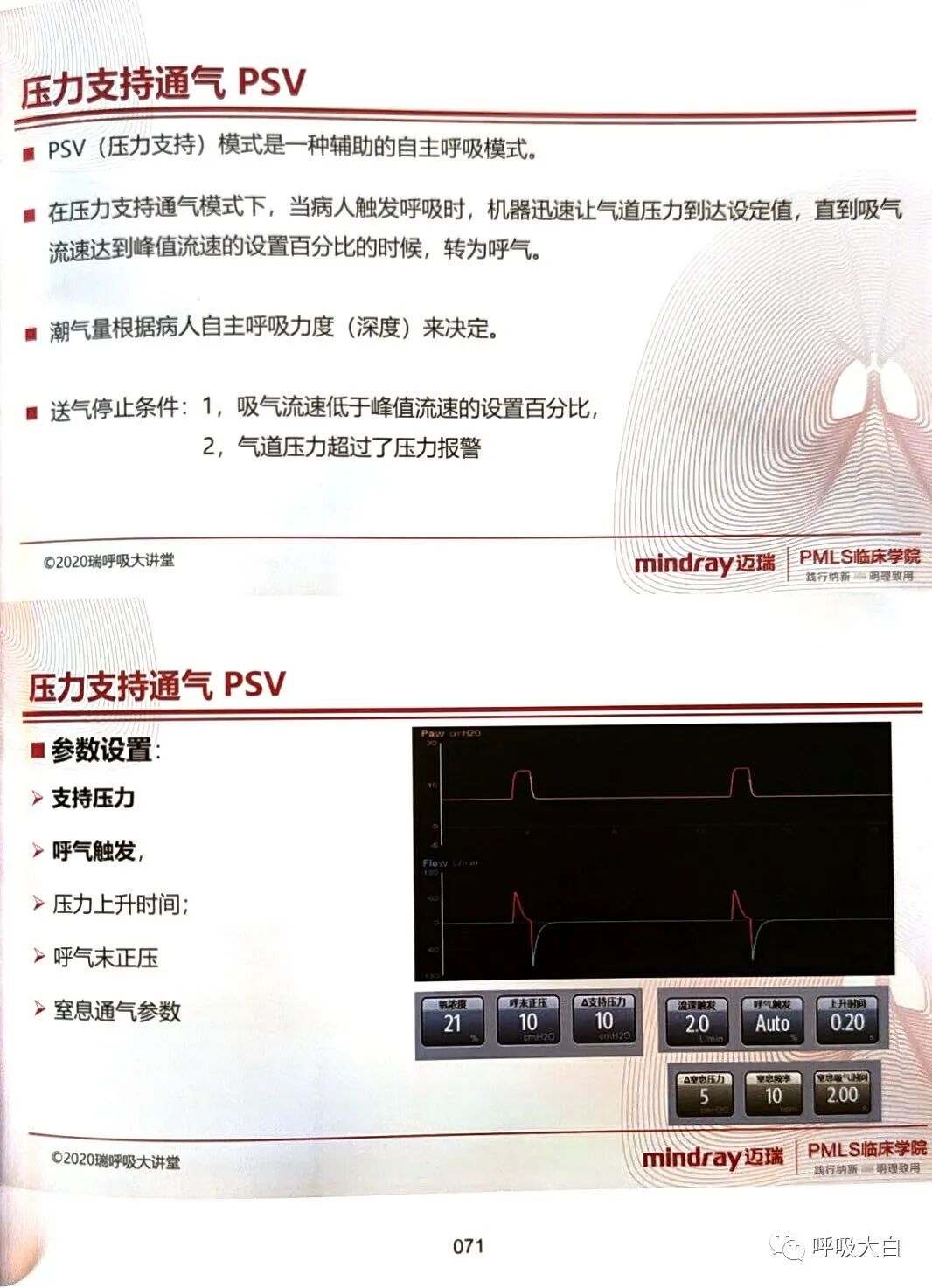 呼吸机pip是什么意思3如何理解通气模式（二）_https://www.jmylbn.com_新闻资讯_第13张