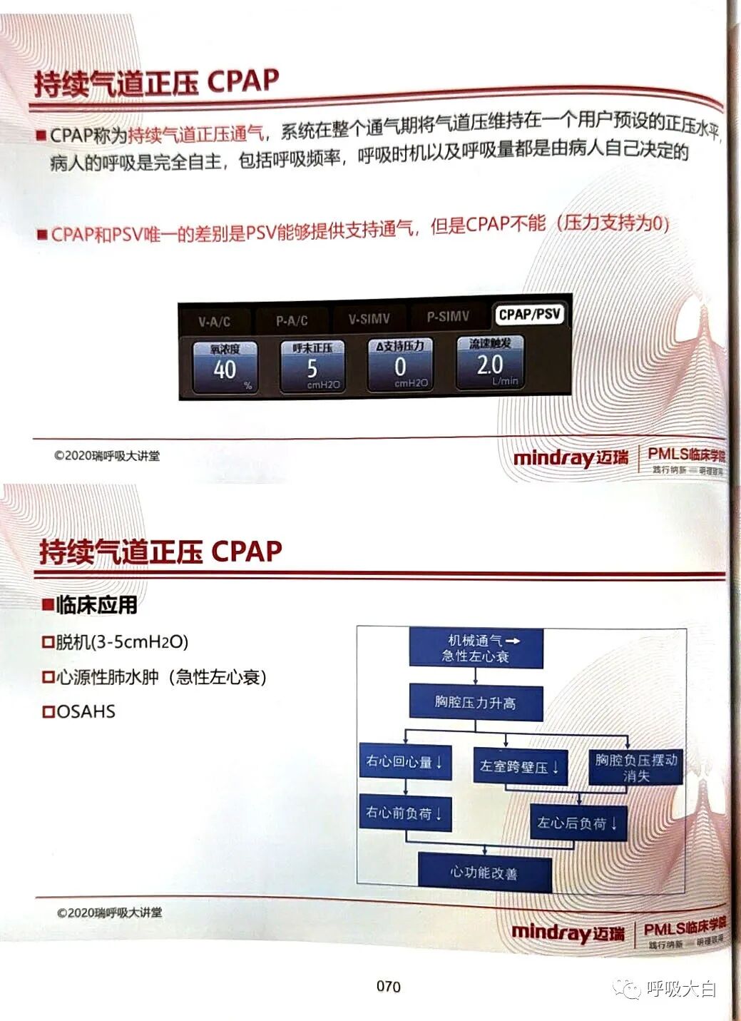 呼吸机pip是什么意思3如何理解通气模式（二）_https://www.jmylbn.com_新闻资讯_第12张