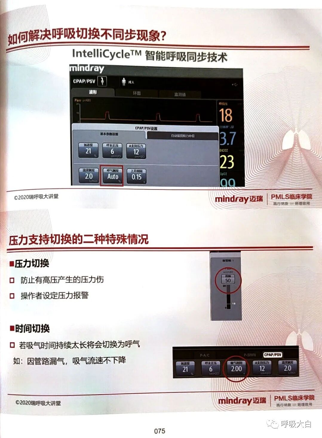 呼吸机pip是什么意思3如何理解通气模式（二）_https://www.jmylbn.com_新闻资讯_第17张