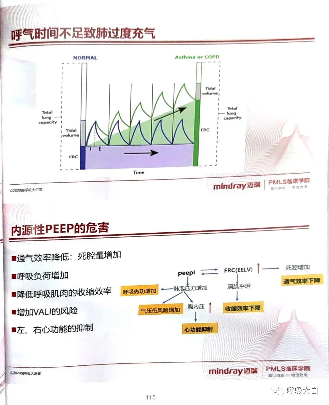 为什么呼吸机人机同步5人机不同步的识别与处理_https://www.jmylbn.com_新闻资讯_第15张