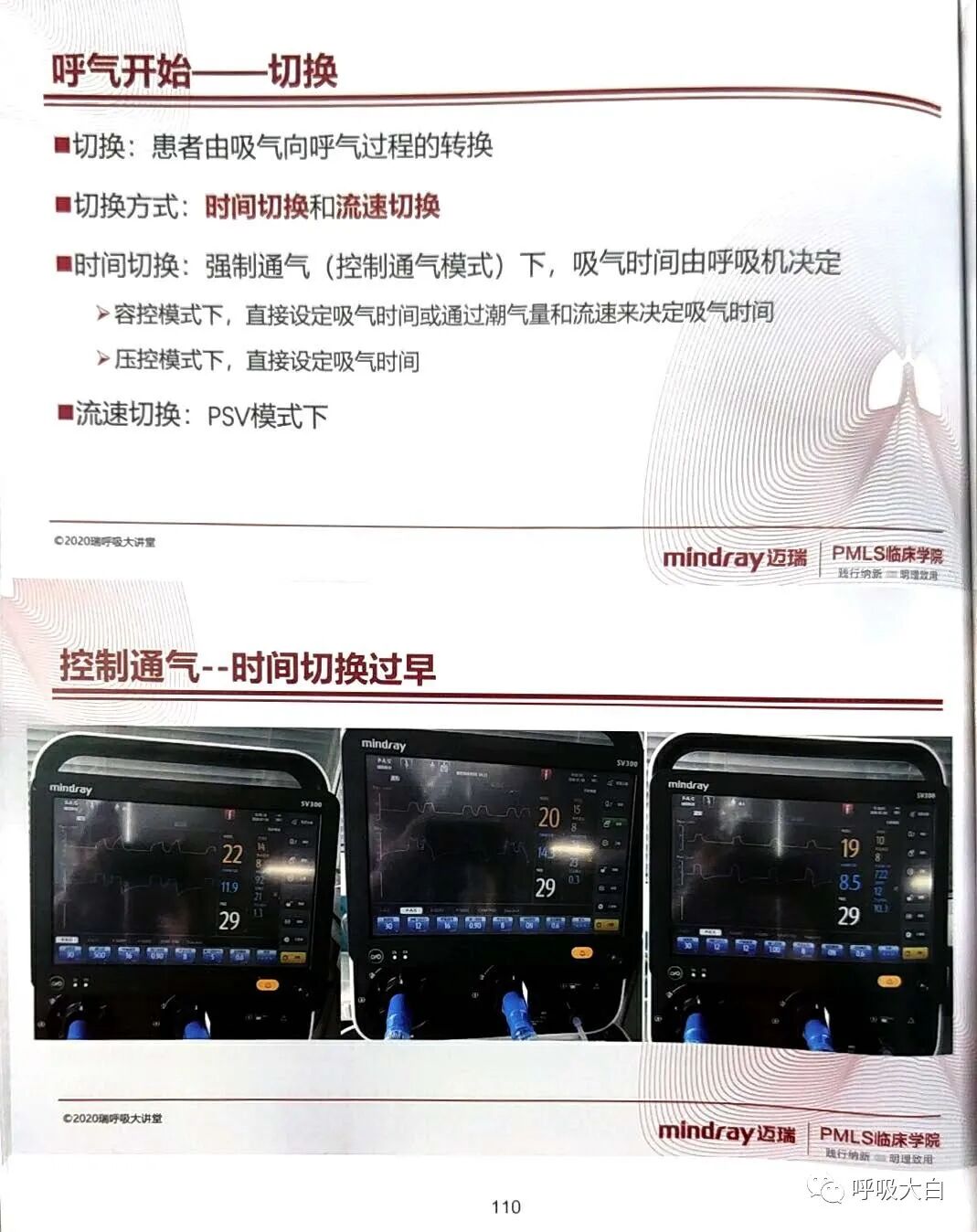 为什么呼吸机人机同步5人机不同步的识别与处理_https://www.jmylbn.com_新闻资讯_第10张