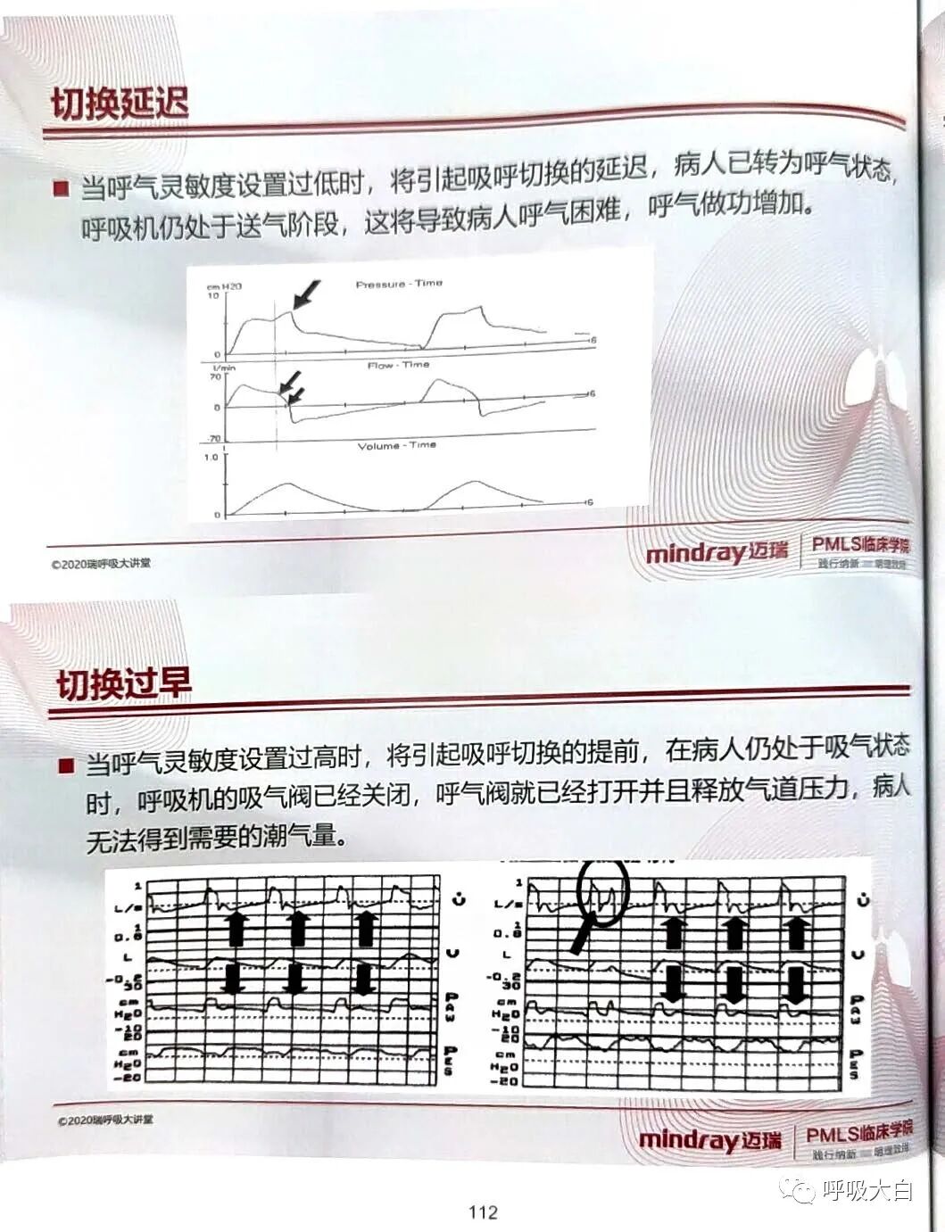 为什么呼吸机人机同步5人机不同步的识别与处理_https://www.jmylbn.com_新闻资讯_第12张