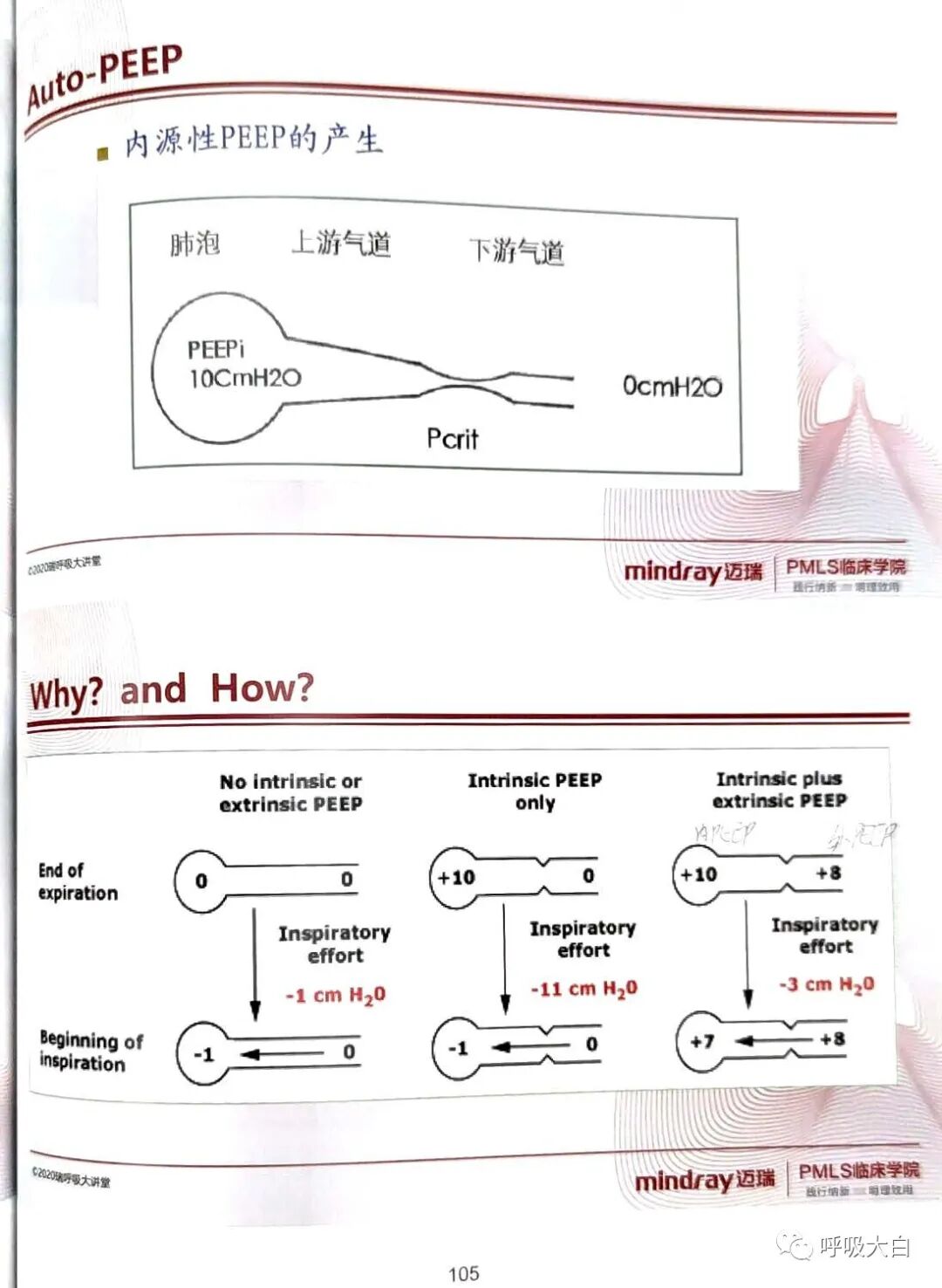 为什么呼吸机人机同步5人机不同步的识别与处理_https://www.jmylbn.com_新闻资讯_第5张