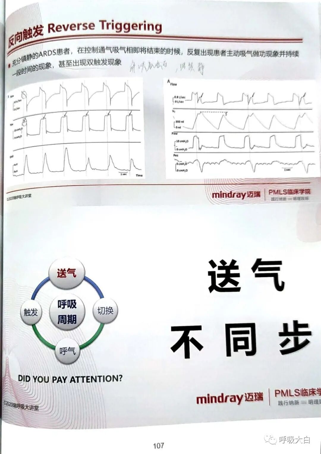 为什么呼吸机人机同步5人机不同步的识别与处理_https://www.jmylbn.com_新闻资讯_第7张