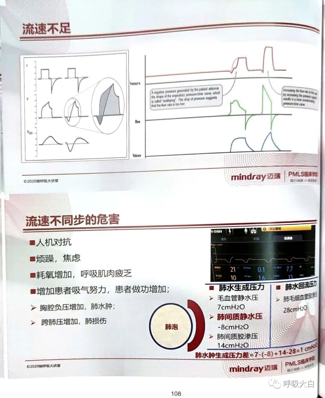 为什么呼吸机人机同步5人机不同步的识别与处理_https://www.jmylbn.com_新闻资讯_第8张