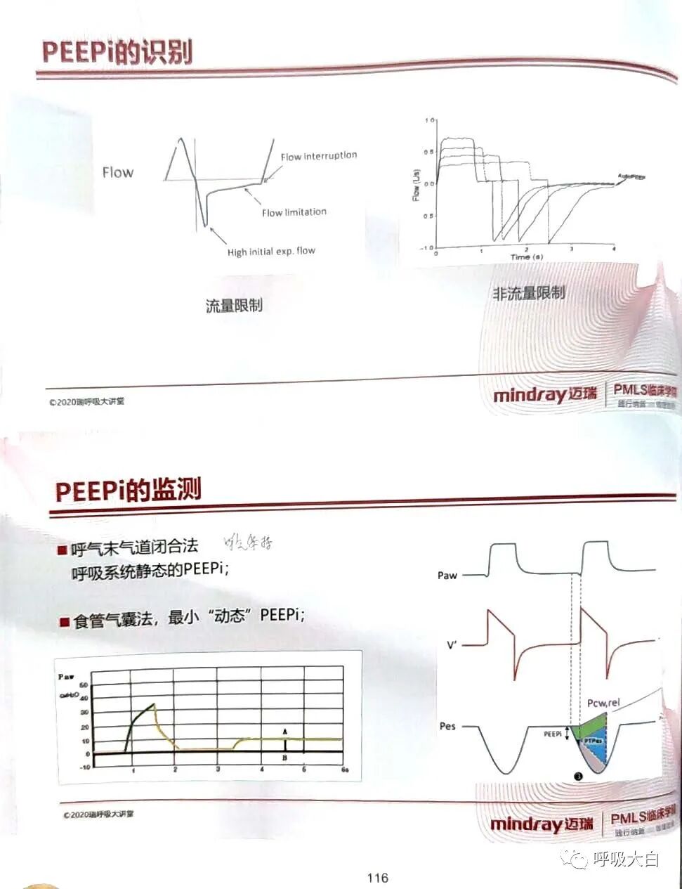 为什么呼吸机人机同步5人机不同步的识别与处理_https://www.jmylbn.com_新闻资讯_第16张