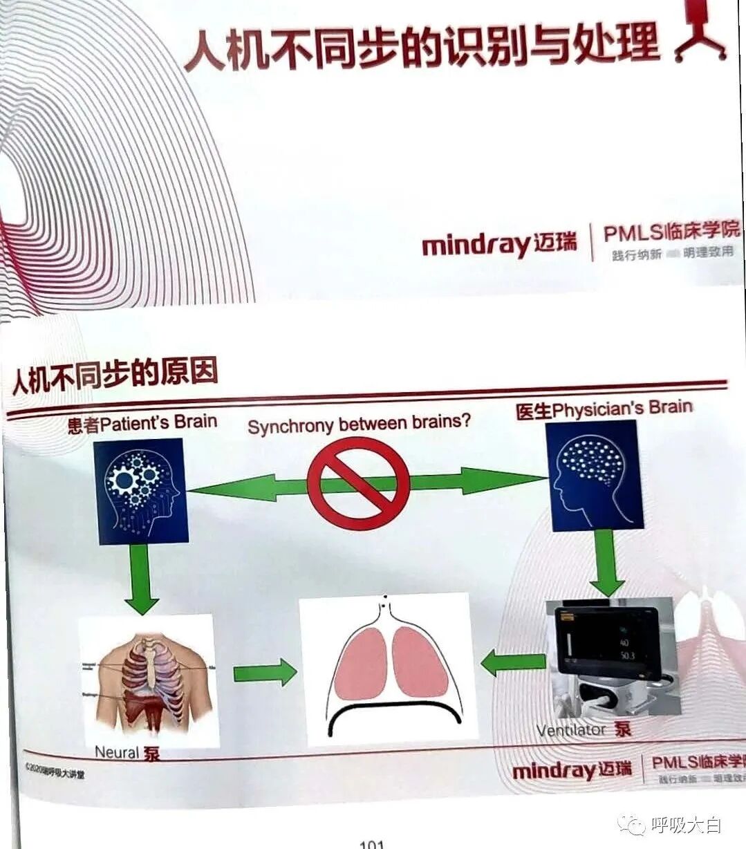 为什么呼吸机人机同步5人机不同步的识别与处理_https://www.jmylbn.com_新闻资讯_第1张