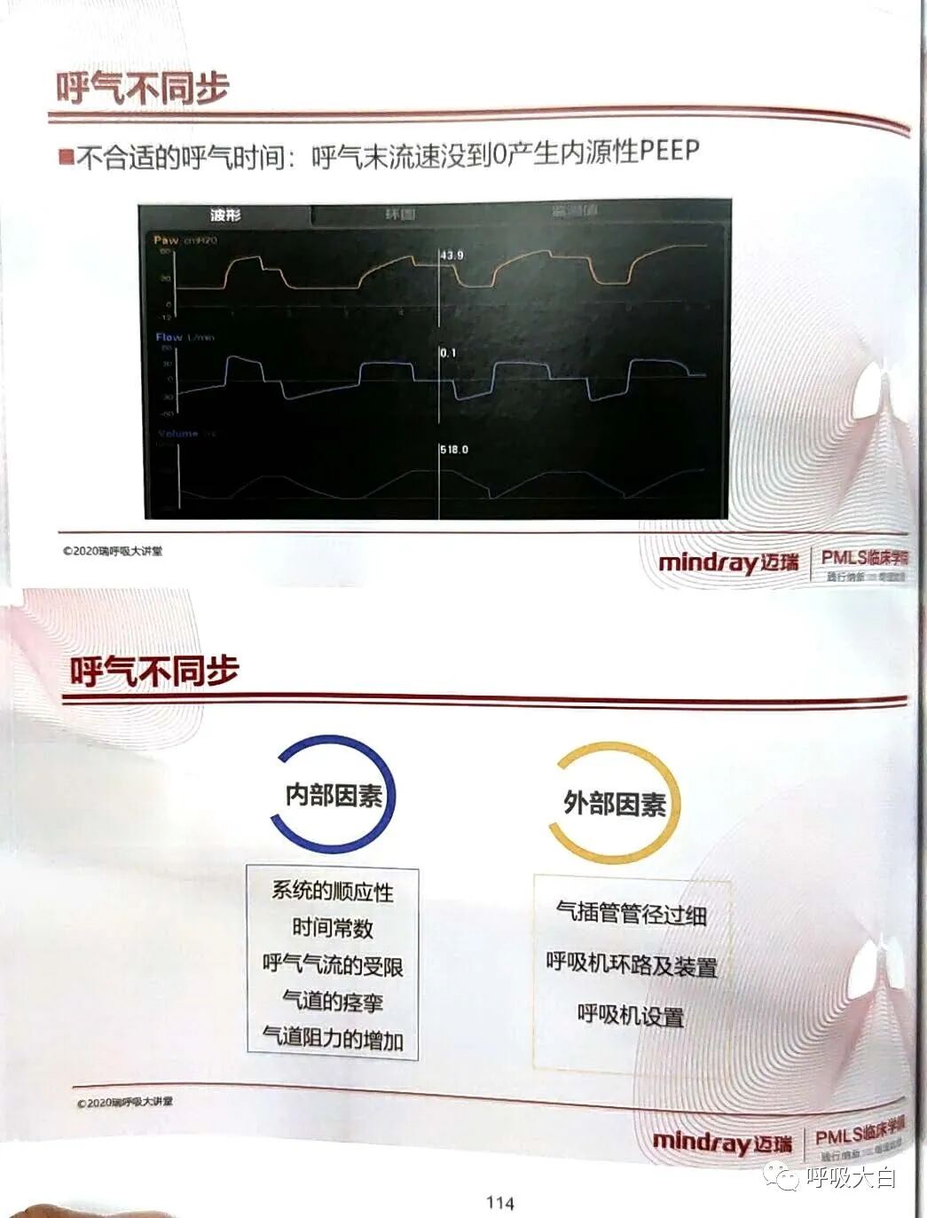 为什么呼吸机人机同步5人机不同步的识别与处理_https://www.jmylbn.com_新闻资讯_第14张