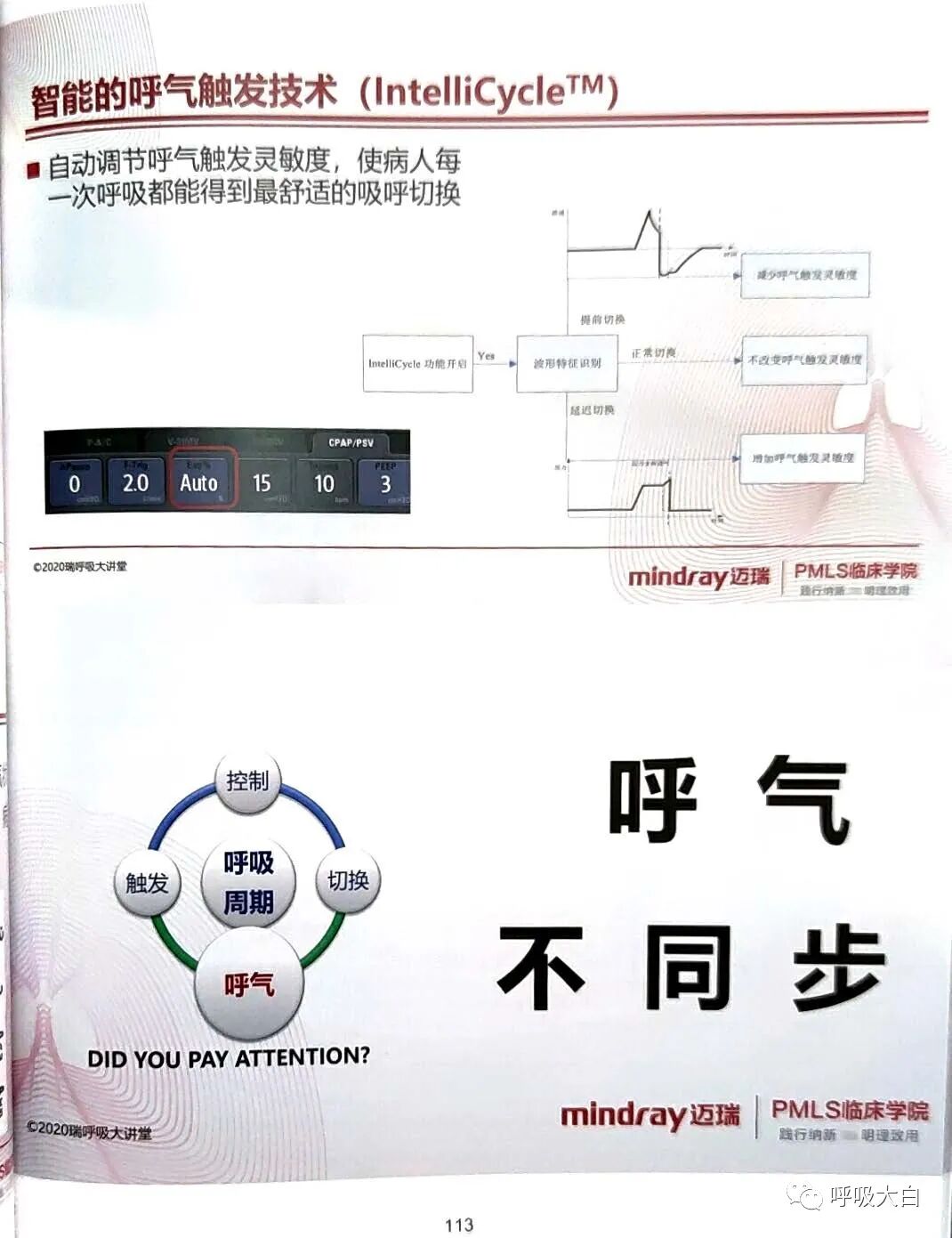 为什么呼吸机人机同步5人机不同步的识别与处理_https://www.jmylbn.com_新闻资讯_第13张
