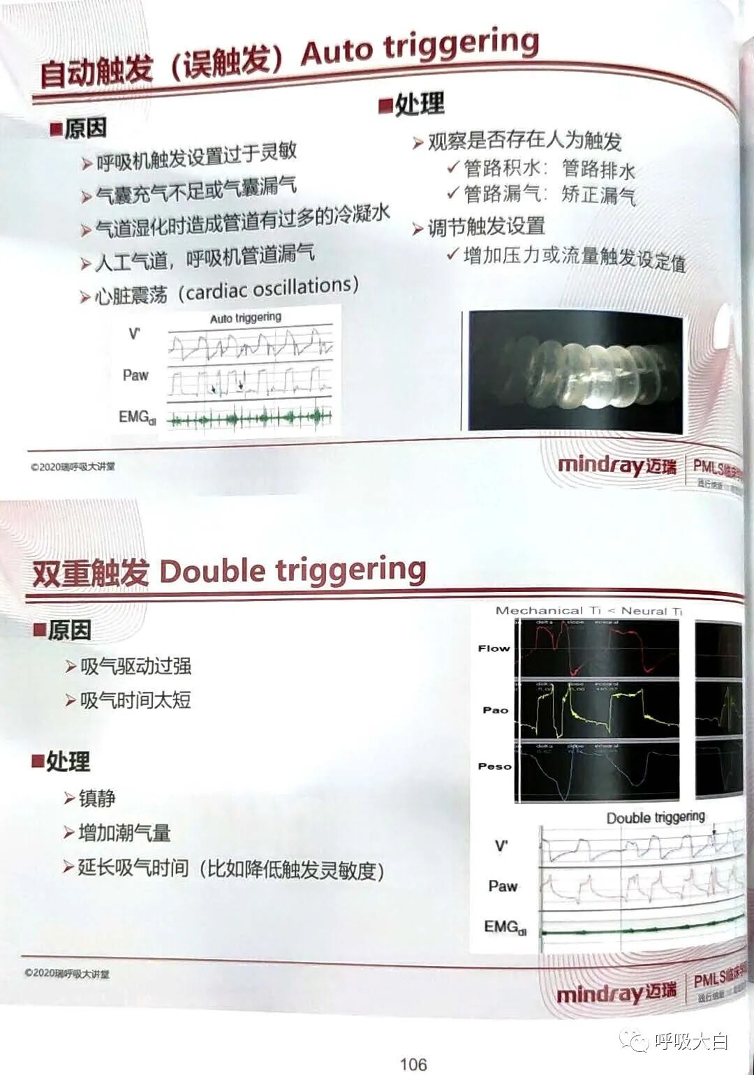 为什么呼吸机人机同步5人机不同步的识别与处理_https://www.jmylbn.com_新闻资讯_第6张