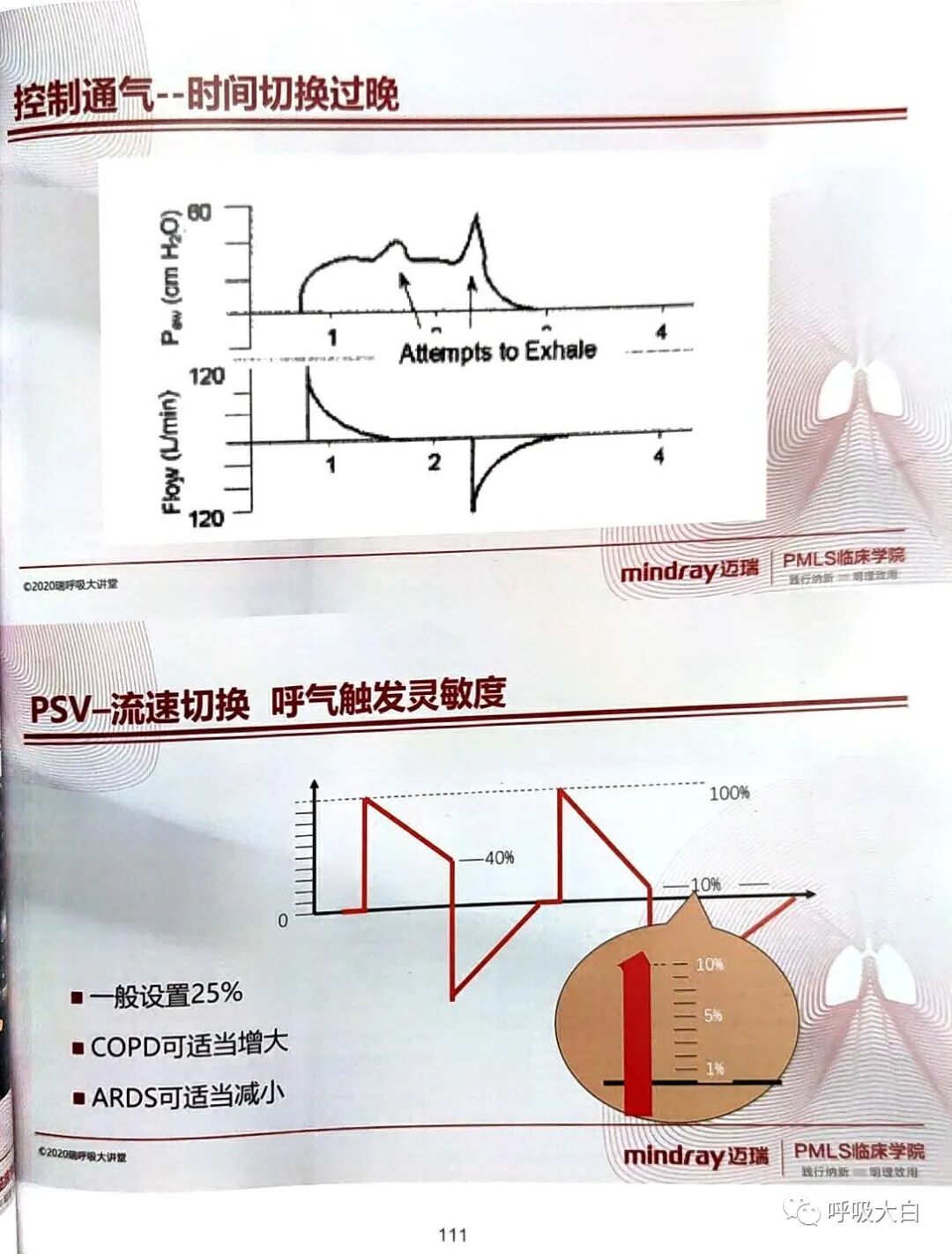 为什么呼吸机人机同步5人机不同步的识别与处理_https://www.jmylbn.com_新闻资讯_第11张