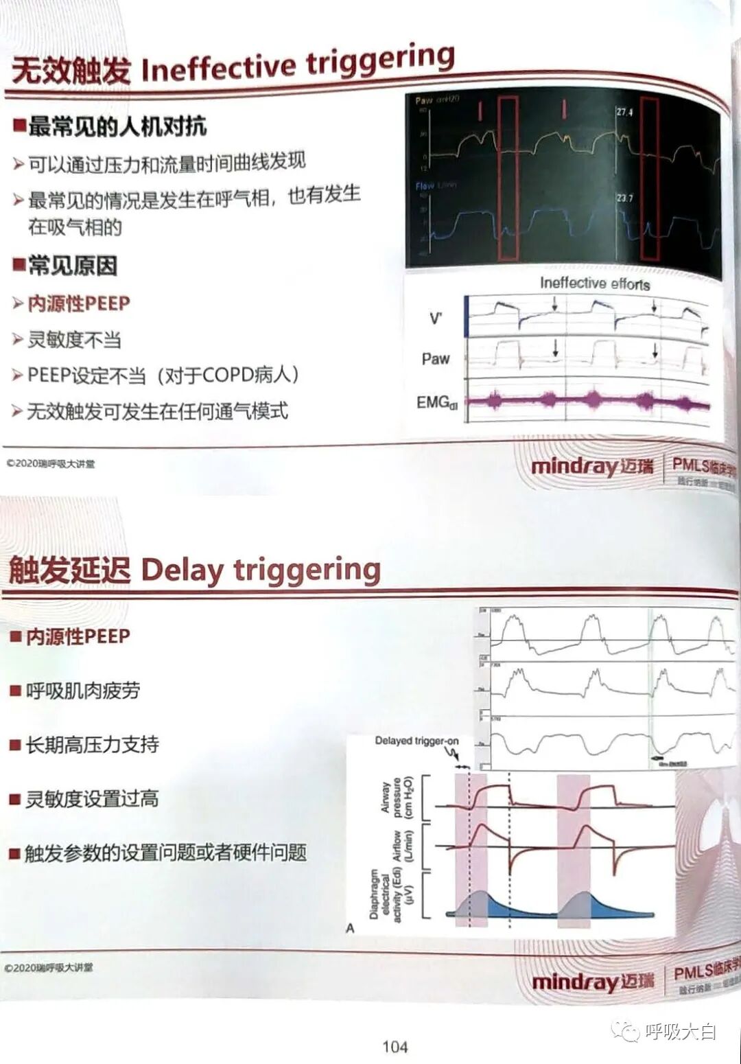 为什么呼吸机人机同步5人机不同步的识别与处理_https://www.jmylbn.com_新闻资讯_第4张