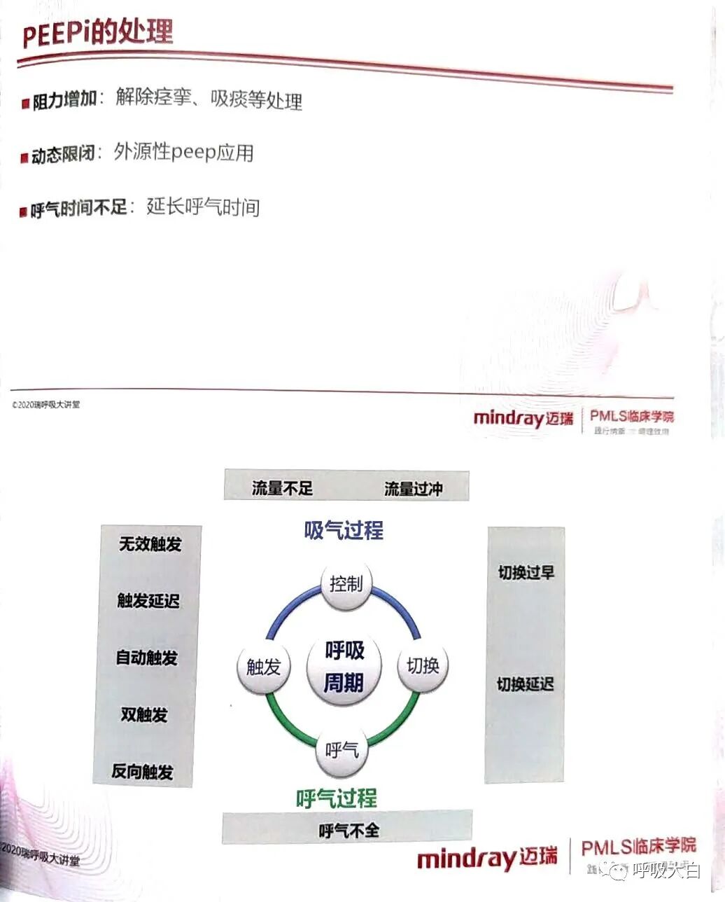 为什么呼吸机人机同步5人机不同步的识别与处理_https://www.jmylbn.com_新闻资讯_第17张