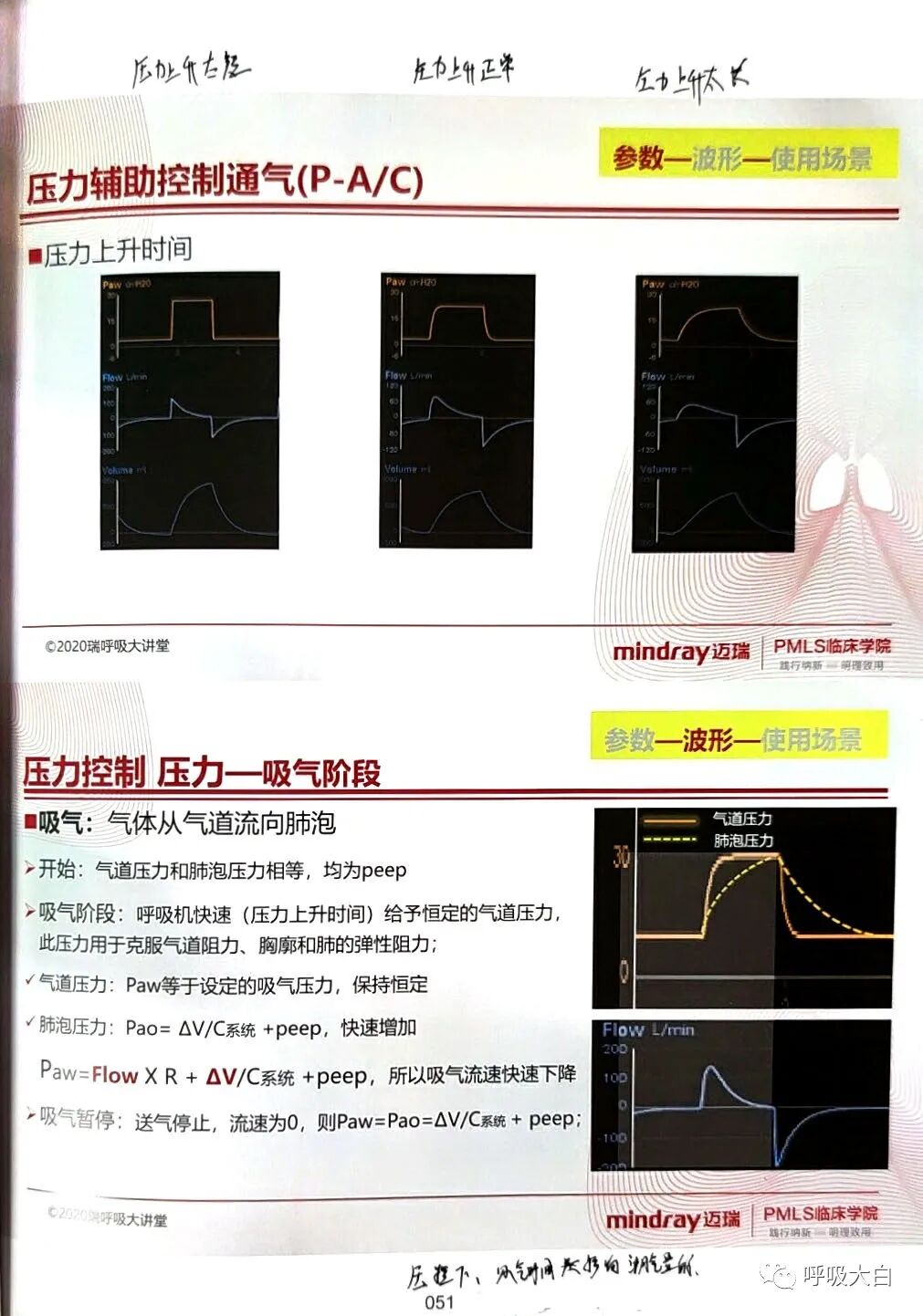 呼吸机pip是什么意思3压力控制辅助通气 P-A／C模式_https://www.jmylbn.com_新闻资讯_第6张