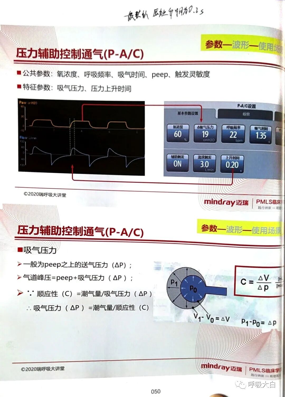 呼吸机pip是什么意思3压力控制辅助通气 P-A／C模式_https://www.jmylbn.com_新闻资讯_第5张