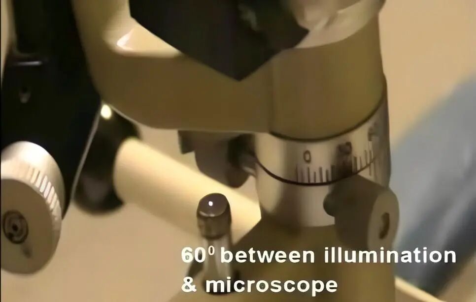 眼压计怎么用Goldmann眼压计（二）：使用方法、注意事项、误差来源_https://www.jmylbn.com_新闻资讯_第7张