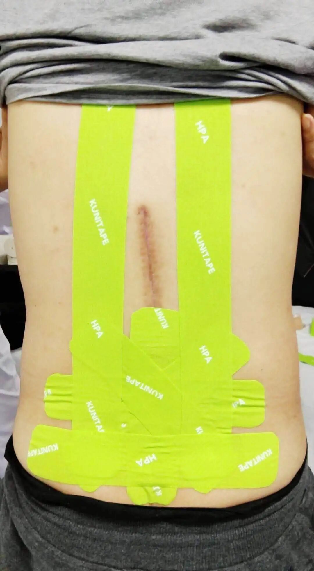 低频磁疗机怎么用【新技术 新设备】陕西省康复医院物理因子疗法科引进低频磁疗机_https://www.jmylbn.com_新闻资讯_第16张