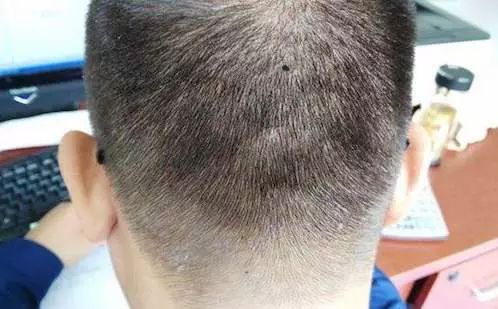 手掌图解男左女右_手掌图解男性_手掌痣相图解男