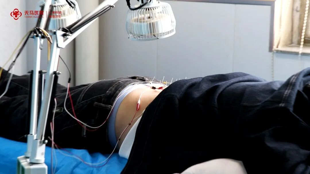 电针理疗是什么科室介绍 - 康复理疗科_https://www.jmylbn.com_新闻资讯_第8张