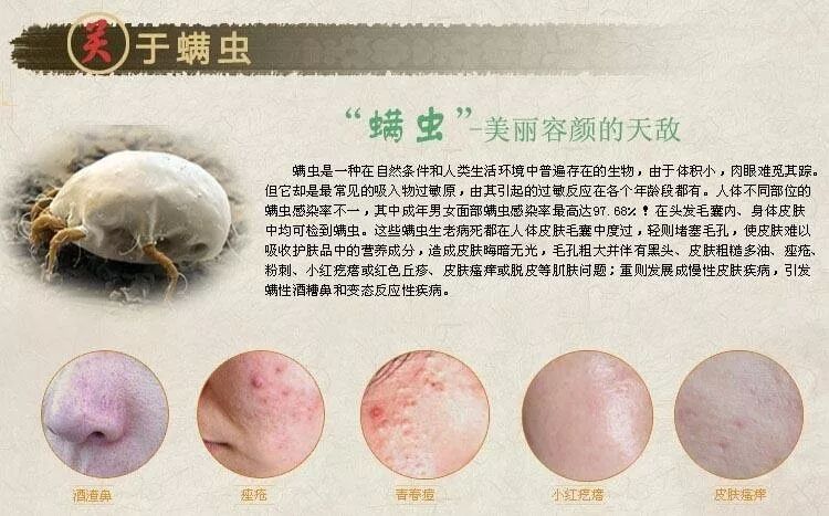 螨虫新四害之首你造么每天1千万只螨虫跟你一起睡