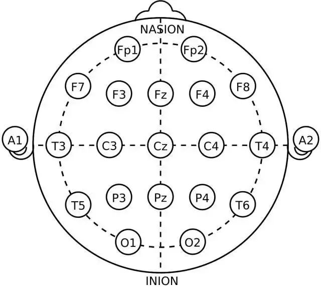 脑电图电极放置示意图图片