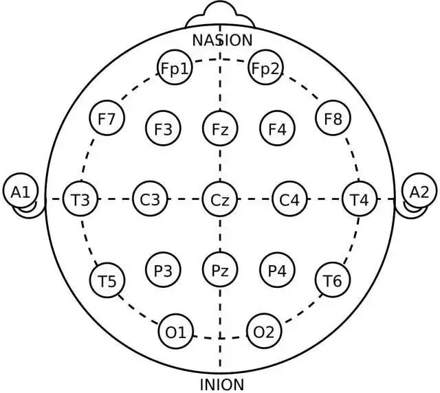 最常用的两种导联,一个是参考导联,就是测量头皮电位和耳朵电位的