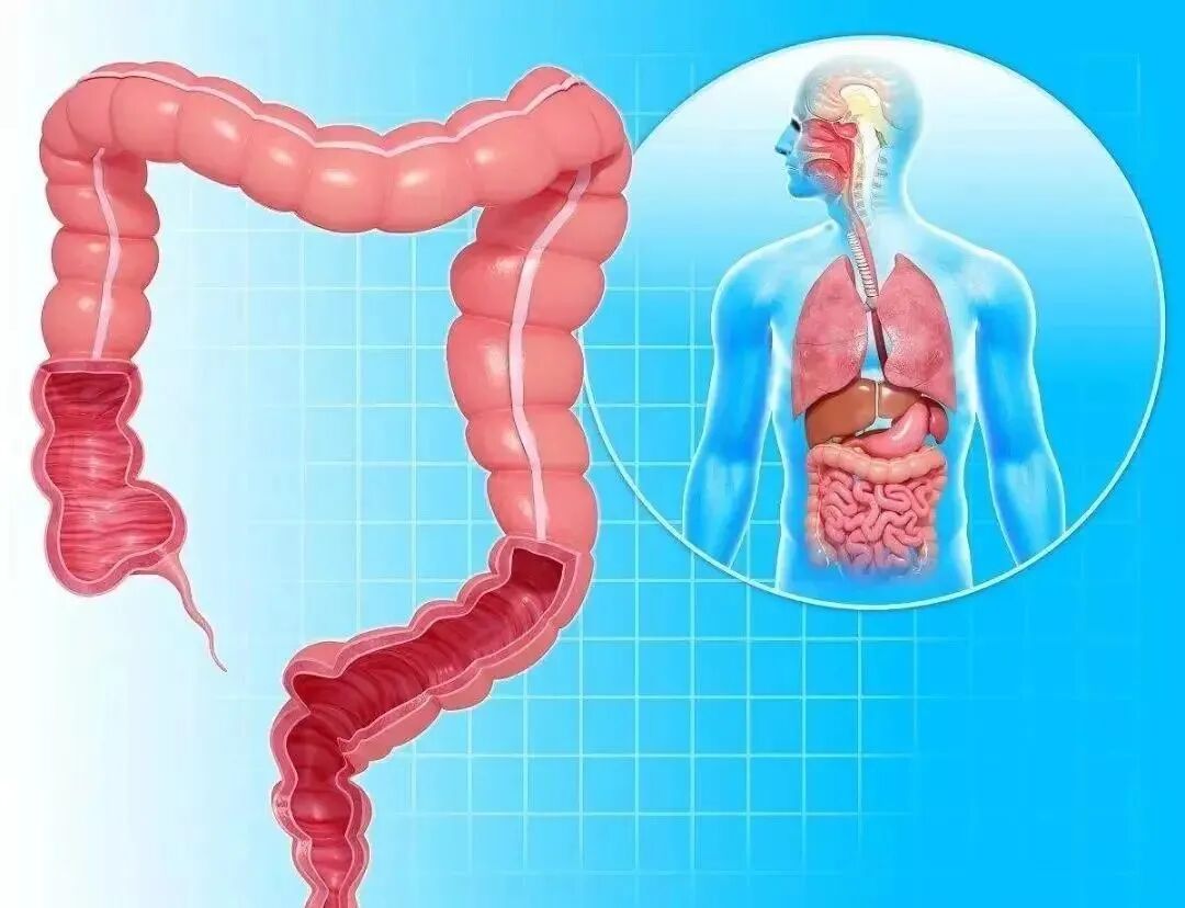 结肠水疗仪怎么用便秘新疗法丨庄浪县中医医院外一科开展结肠水疗仪治疗项目——给结肠做个SPA_https://www.jmylbn.com_新闻资讯_第3张