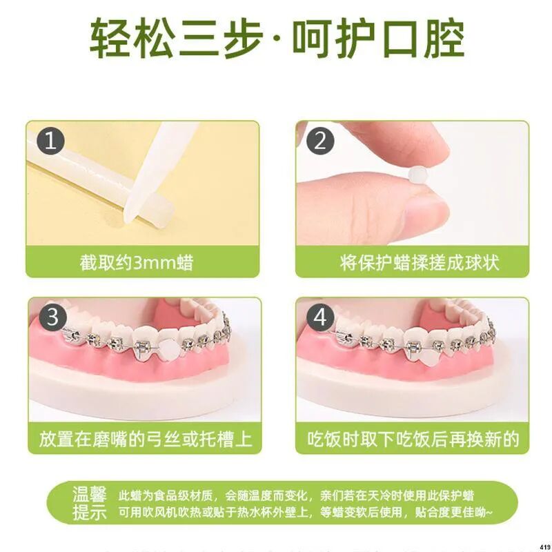 口腔颊面管怎么放置牙套兄，请你不要再磨我嘴了！_https://www.jmylbn.com_新闻资讯_第14张