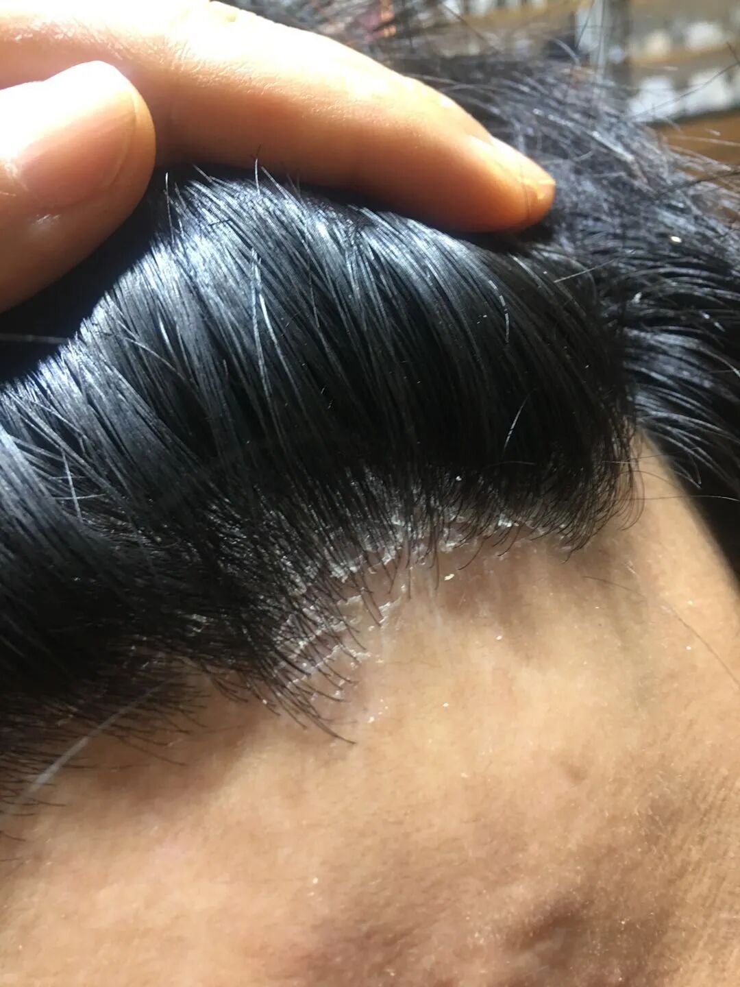 头皮亚健康状态？还不赶快来养发！