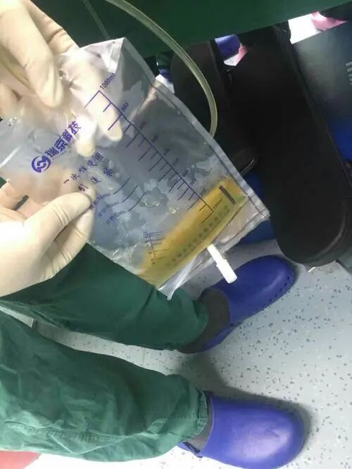 为什么负压引流胸腔闭式引流没有你想的那么简单_https://www.jmylbn.com_新闻资讯_第2张