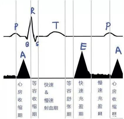 什么是同步心电图心电图如何与心脏超声结合到一起_https://www.jmylbn.com_新闻资讯_第5张