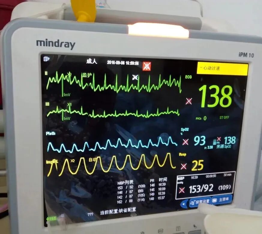 怎么提高氧饱和65血氧饱和度 ＞ 95% 就是正常吗？ 不同疾病血氧饱和度应该维持多少？_https://www.jmylbn.com_新闻资讯_第2张